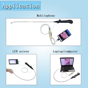 Uréteroscope flexible jetable USB 7.5FR pour usage urologique humain - Product Image 3