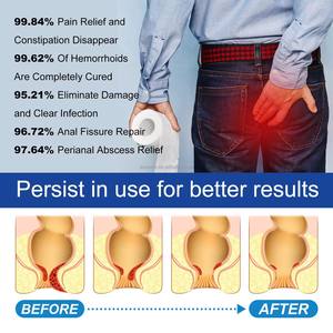 Травяной крем от геморроя на заказ для анальной трещинки и кровотечения, китайские травяные экстракты, медицинское обслуживание - Product Image 3