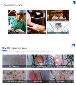 Analizador Capilar 3D 2026, Máquina de Análisis de Cuero Cabelludo y Piel para la Detección del Crecimiento del Cabello, Material ABS, Dispositivo de Prueba Inalámbrico - Product Image 3