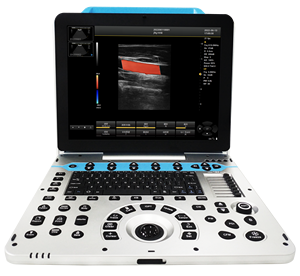 DMSU09 Instrumento de Diagnóstico por Ultrasonido Doppler a Color Portátil para Animales, Escáner de Examen Veterinario por Ultrasonido - Product Image 4