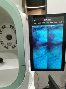Máquina Analizadora de Piel Multiespectral con IA, Detecta Humedad, Grasa, Pigmentación, Lámpara Detectora de Piel Facial, Detección UV - Product Image 6