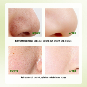 TWG RTS <span class=keywords><strong>Exfoliante</strong></span> Facial Blanqueador Espinilla Eliminador <span class=keywords><strong>de</strong></span> Acné <span class=keywords><strong>Exfoliante</strong></span> Cuidado <span class=keywords><strong>DE</strong></span> LA Piel Limpieza Profunda Albaricoque <span class=keywords><strong>Avena</strong></span> BHA <span class=keywords><strong>Exfoliante</strong></span> Facial - Product Image 4