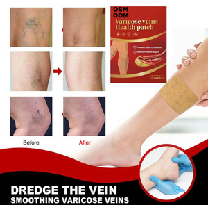 Plester Herbal OEM Plester Cina untuk Perawatan Kaki Efektif untuk Varises Vaskulitis Flebitis Varises Laba-laba - Product Image 2