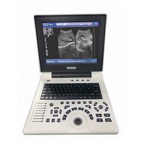 Pemindai <span class=keywords><strong>Ultrasound</strong></span> <span class=keywords><strong>Laptop</strong></span> convex probe dan mesin <span class=keywords><strong>ultrasound</strong></span> layar LED linear probe dengan 2 konektor probe - Product Image 2