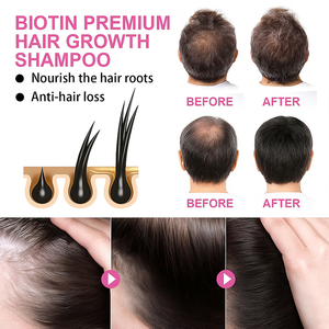 OEM Hữu Cơ thuần chay chăm sóc tóc thiết lập giữ ẩm & nuôi dưỡng dầu gội & điều cho tất cả các loại tóc truyền hành tây Biotin hương thảo - Product Image 3