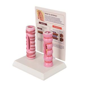 Modèle de comparaison de la trachée humaine saine et de la trachée asthmique |   <span class=keywords><strong>Aide</strong></span> pédagogique anatomique médicale pour l'éducation du système <span class=keywords><strong>respiratoire</strong></span> - Product Image 6