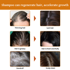 EELHOE Riz Dense Deep Clean Épais Hydratant Racine <span class=keywords><strong>Solide</strong></span> Soin des Cheveux Shampooing - Product Image 3