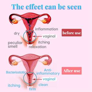Gel vaginal raffermissant antibactérien <span class=keywords><strong>pour</strong></span> femmes, nourrissant, à l'extrait de plantes nano-argent, soin <span class=keywords><strong>intime</strong></span> hygiénique, lubrifiant - Product Image 4