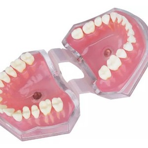 Modèle dentaire HDF M7008 avec gencives souples et dents extractibles, pour démonstration pédagogique, équipement d'enseignement médical et de thérapie orale - Product Image 5