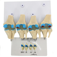 PVC Simulation Médicale Squelette Modèle Pathologie Humaine Genou Modèle D'anatomie