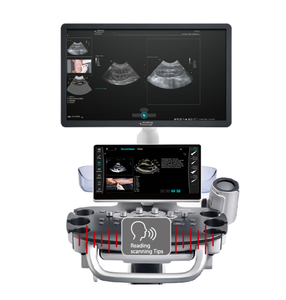 Mingray Vetus 50 spesialis mesin Ultrasound, sistem diagnostik Ultrasound untuk hewan - Product Image 4