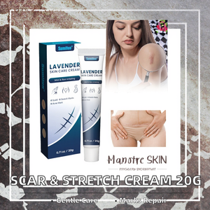 ครีมสมุนไพรกำจัดรอยแผลเป็นและครีมซ่อมแซมรอยครีมยืด20กรัม - Product Image 2