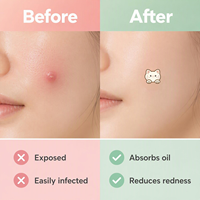 Patchs Hydrocolloïdes Anti-Acné Multi-Formes aux Huiles Essentielles, Couvre-Boutons Invisibles en Forme de Chat, Certifiés CE, Vente en Gros, Soins du Visage
