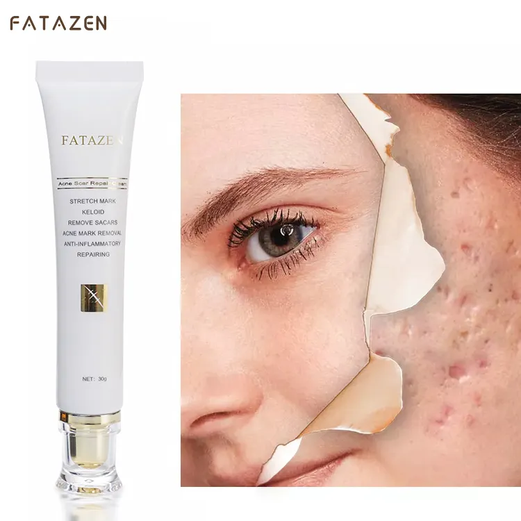 Private Logo Herbal Effective Skin Repairing Gel Natural Acne Pimple Mark Stretch Marks Remove Face Gel Scar Removing Cream