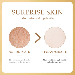 OEM ODM özel etiket SADOER Lysosomal Nicotinamide <span class=keywords><strong>C</strong></span> vitamini beyazlatma onarım akne dondurularak kurutulmuş toz seti cilt bakımı - Product Image 5