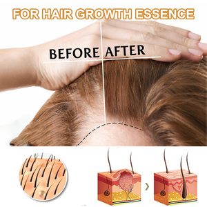Agua de arroz orgánica de etiqueta privada, el mejor suero para el crecimiento del cabello, elixires naturales para el crecimiento del cabello - Product Image 4