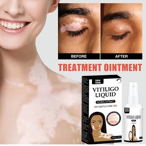 Produsen Grosir Krim Kesehatan <span class=keywords><strong>Vitiligo</strong></span> Produk Perawatan Kulit Bahan Herbal Semprotan Cair <span class=keywords><strong>Vitiligo</strong></span> - Product Image 3