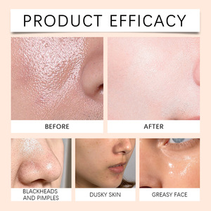 Nettoyant doux qui nettoie en douceur la peau, rafraîchissant et non desséchant, doux et hydratant. - Product Image 5