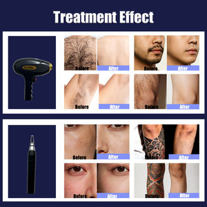 เครื่องกำจัดขนด้วยไดโอดแบบมืออาชีพ 2 in 1 สำหรับกำจัดขนทั่วร่างกาย กำจัดรอย<span class=keywords><strong>สัก</strong></span> และฟื้นฟูผิวแบบตั้งโต๊ะ - Product Image 4