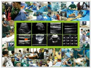 Sonde échographique convexe linéaire 3-en-1 à 192 éléments, la plus avancée, pour <span class=keywords><strong>scanner</strong></span> vasculaire portable vétérinaire et humain, compatible avec les appareils iOS, Android et Windows - Product Image 4