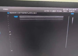 Sonda lineal electrónica para reparación de transductor de ultrasonido y sonda para H60/WS80A/RS80A 220V 3 años de garantía - Product Image 4