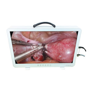 27 polegadas FHD Portátil Telepack Endoscópio Câmera Para Histeroscopia Laparoscopia Urologia - Product Image 1
