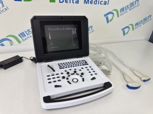 Escáner de Ultrasonido Blanco y Negro de Alta Calidad para Hospital, Sistema de Diagnóstico Veterinario, Máquina de Ultrasonido Portátil para Humanos - Product Image 4