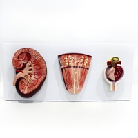 Modelo Anatómico de Glómerulo Renal con Ampliación, PVC, Ciencia Médica