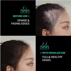 Minyak rambut Batana organik Premium Formula 2 dalam 1 untuk memperkuat pertumbuhan rambut - Product Image 3