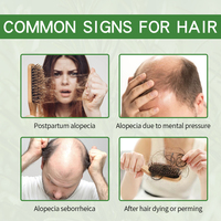 Aceite de Romero 100% Puro y Natural al por Mayor para el Crecimiento del Cabello, con Biotina, Tratamiento para el Cuero Cabelludo y Cuidado de Puntas Abiertas