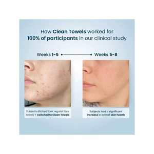 Toallitas Desechables Shesmile Clean Towels XL, Paquete de 50, para Desmaquillar Adultos - Product Image 2