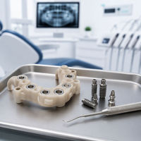 Pièces en plastique usinées CNC sur mesure, PEEK, acrylique, implant dentaire, pièces tournées de précision, machines, alliage d'aluminium usiné