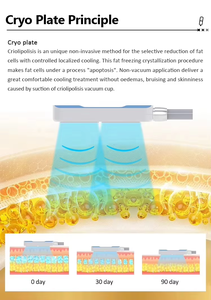 Macchina Professionale per <span class=keywords><strong>Crioterapia</strong></span> Dimagrante con 4 Pad di Raffreddamento e Terapia EMS Comfort per Tutto il Corpo - Product Image 2