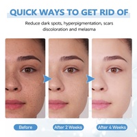Acide hyaluronique de marque privée crème hydratante pour le visage éclaircit les imperfections et les taches brunes crème pour le visage