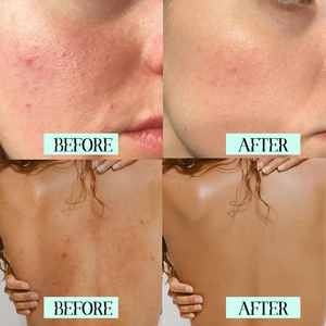 Set de Cuidado de la Piel Vegano con Ácido Glicólico de Marca Propia, Rejuvenecedor, Orgánico, Natural, Exfoliante, Lavado Facial y Corporal, Tónico, Humectante, Loción - Product Image 4