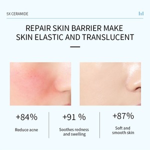 En çok satan 70% güçlü Ceramide nemlendirici krem vücut ve yüz için peptidler ile özelleştirilmiş cilt bakım ürünleri - Product Image 5