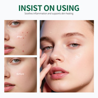 Kit de Soins Anti-Acné Marque Blanche : Acide Hyaluronique, Acides Aminés + Céramides, Hydratant, Acide Salicylique, Zinc pour Peaux Grasses