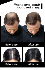 <span class=keywords><strong>Poudre</strong></span> volumisante Sevich de qualité supérieure à tenue forte pour <span class=keywords><strong>cheveux</strong></span>, <span class=keywords><strong>poudre</strong></span> densifiante pour couvrir la <span class=keywords><strong>calvitie</strong></span>, fibres capillaires organiques - Product Image 2