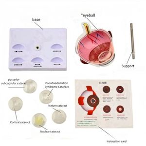 Fabricant ventes directes modèle d'oeil anatomique cataracte PVC matériel pour <span class=keywords><strong>ophtalmologie</strong></span> <span class=keywords><strong>collège</strong></span> médecin outils sciences médicales - Product Image 2