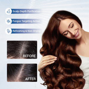 Shampoo antifongique pour le traitement du cuir chevelu, contre la dermatite séborrhéique, les pellicules, les démangeaisons et la sécheresse - Product Image 2