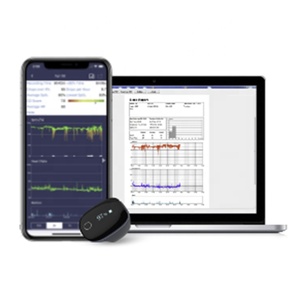 Wellue O2Ring Apparecchiatura per Analisi del Sangue, Pulsossimetro per Frequenza Cardiaca e Saturazione di Ossigeno, Monitor per Apnea Notturna - Product Image 2