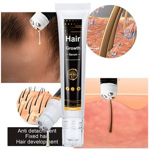 Indio salvaje <span class=keywords><strong>mejor</strong></span> <span class=keywords><strong>tratamiento</strong></span> orgánico Romero ricino Semilla Negra bebé aceite de crecimiento rápido del <span class=keywords><strong>cabello</strong></span> <span class=keywords><strong>para</strong></span> mujeres negras hombres Etiqueta Privada - Product Image 4