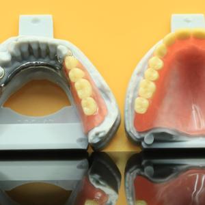 Metaal 3D-dentale print, compact en stevig, gemaakt van kobalt-chroomlegering - Product Image 1