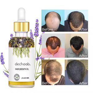 Dechaab produk pertumbuhan rambut cepat Serum pertumbuhan rambut botak minyak jarak alami Rosemary pertumbuhan rambut untuk pria - Product Image 1