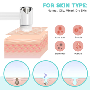 Nouvelle brosse exfoliante rotative 2026 pour le visage, usage domestique, brosse de beauté multifonction pour un nettoyage en profondeur, brosse nettoyante manuelle pour le visage, usage domestique - Product Image 5