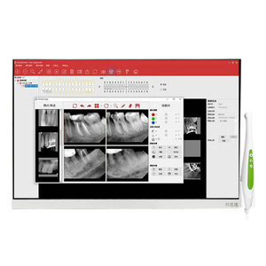 เครื่องคอมพิวเตอร์เอ็นโดสโคปทางทันตกรรมแบบออลอินวัน ขนาด 24 นิ้ว พร้อมจอภาพและกล้องสำหรับการถ่ายภาพและการสังเกตภายในช่องปาก - Product Image 2