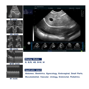 Pemindai Ultrasound medis hitam dan putih portabel untuk instrumen kedokteran hewan manusia dan kuda dalam Diagnosis - Product Image 6