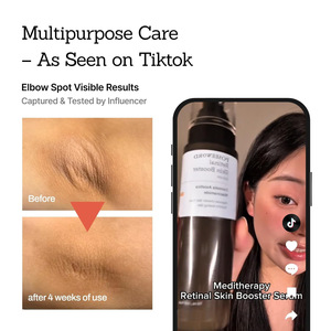 Suero Iluminador de Piel, Loción Facial Hidratante con Retinol y Niacinamida, Suero Facial Aclarante - Product Image 4