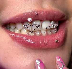 ODM OEM fabrika kristal yeni stil çok şekiller diş taşlar fabrika DIY diş Gem kiti - Product Image 4