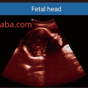 Appareil d'échographie Doppler couleur 3D/4D en temps réel avec écran LED de 15 pouces pour les applications en gynécologie et obstétrique EO-C60 - Product Image 6